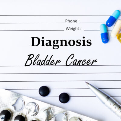 5 Early Warning Signs of Bladder Cancer