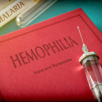 Early Signs and Causes of Hemophilia