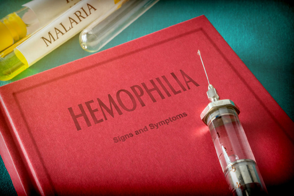 Early Signs and Causes of Hemophilia