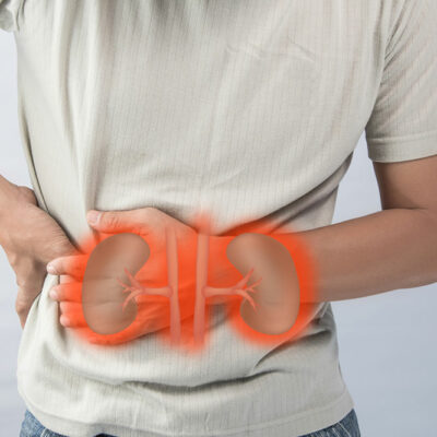 Risk Factors Linked to Kidney Cancer