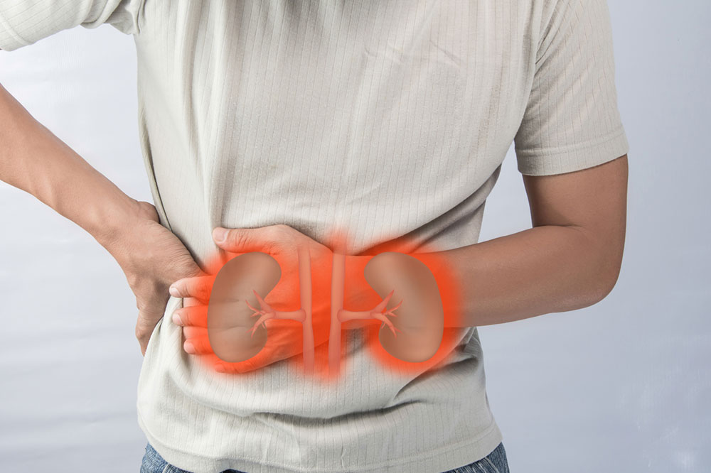 Risk Factors Linked to Kidney Cancer