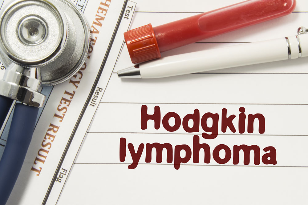 7 Risk Factors for Hodgkin&#8217;s Lymphoma