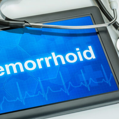 Causes and Diagnosis of Hemorrhoids