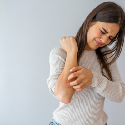 6 Health Conditions Linked to Psoriasis