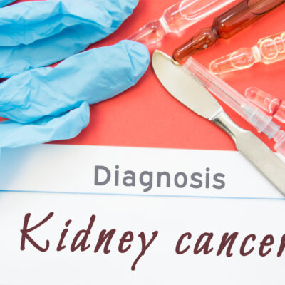 Early Symptoms of Kidney Cancer