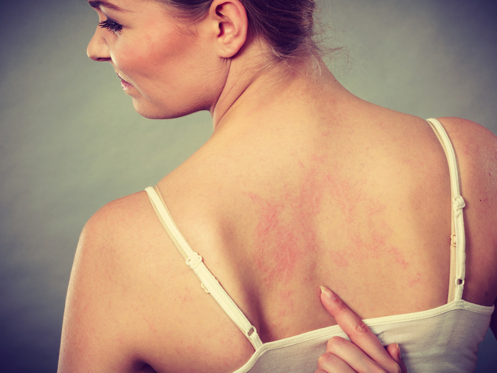 6 Health Conditions Linked to Psoriasis and Treatment Options